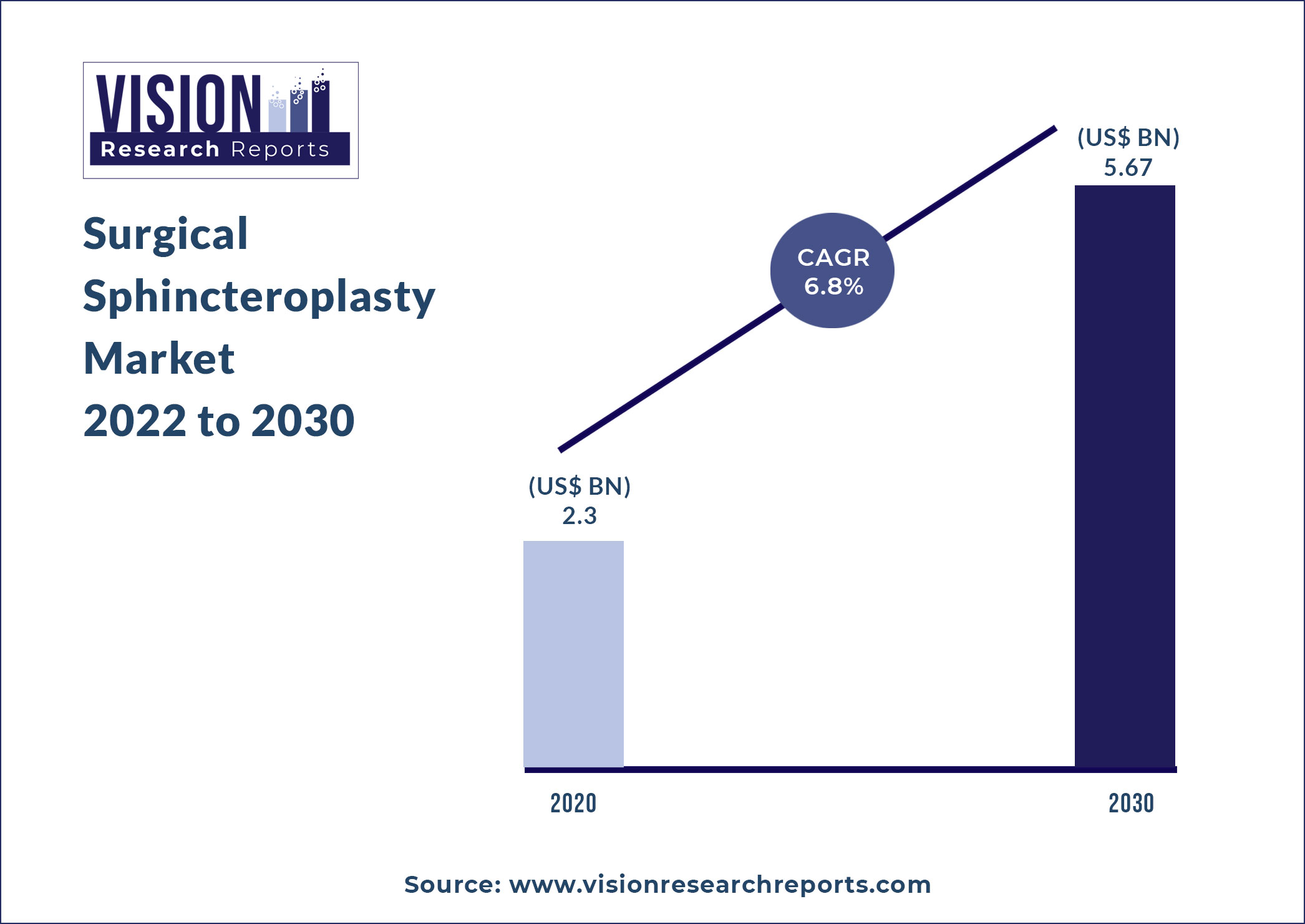 Surgical Sphincteroplasty Market Size 2022 to 2030